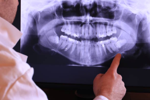 Best Broken or Chipped Tooth Repair in Ocean City, NJ