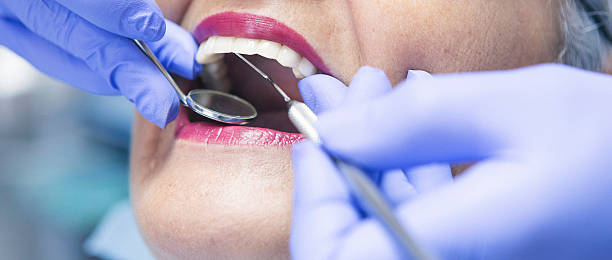 Best Emergency Cosmetic Dentistry (e.g., broken veneers) in Ocean City, NJ